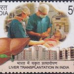 Liver Transplantation in India